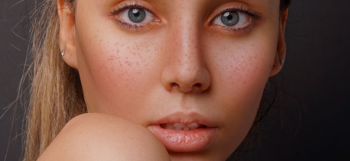 5 ways to support lymphatic health and system phoito by hosein shirvani